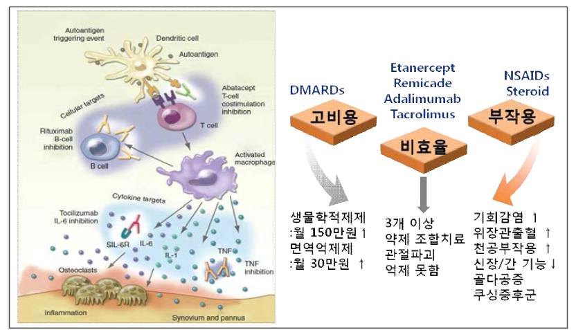 골관절염 치료제 현황 및 치료의 한계