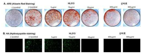 AR 및 HA 염색을 통한 조골세포 분화능 평가