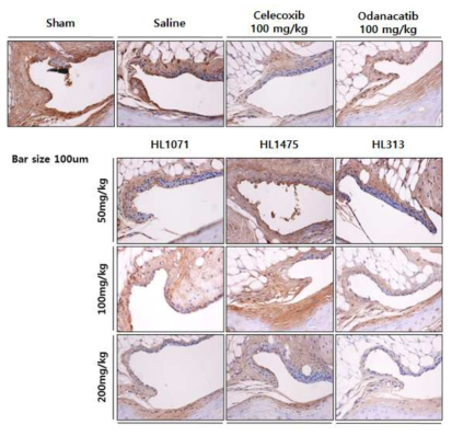 CD68 면역조직화학을 통한 군 별 Macrophage-like synoviocyte 분포