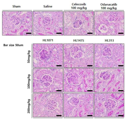 투여군 별 신장 내 사구체 손상 관찰 결과
