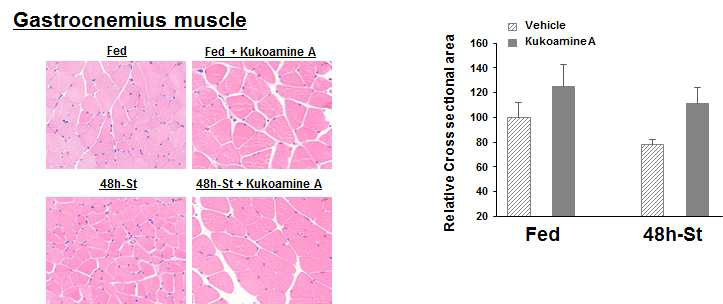 Fasting에 의한 mice의 GA 근육의 CSA 비교