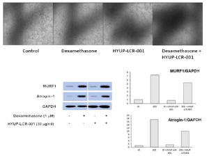 지골피 추출물에 의한 C2C12 myotube의 모양변화 및 MURF1, Atrogin-1의 함량 변화