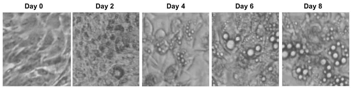 3T3-L1 세포의 분화과정. Day0(postconfluent 2day)에 분화유도제를 처리하면 지방세포로 분화가 시작