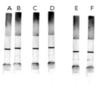 Troponin I 면역 진단 스트립결과 (A,B:control; C,D: 10 ng/ml; E,F: 1ug/ml)