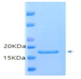 Micoplasma L7/L12 검출 표적 항원