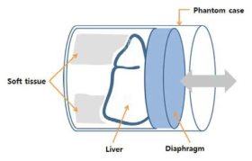Liver 팬톰 세부 구성도