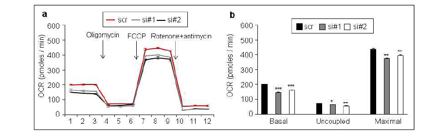 PRDM4 저해에 의한 갈색지방세포의 대사량 감소