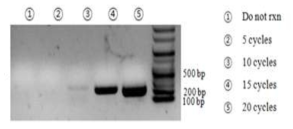 PCR 수행 후 증폭된 유전자의 gel 사진