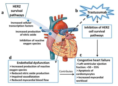 Herceptin 치료에 의한 심장독성 기작