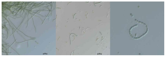 남조류 Anabaena의 광학현미경 사진