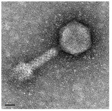 Transmission electron micrographs of bacteriophage BK30P particles