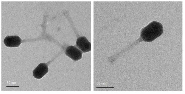 Transmission electron micrographs of bacteriophage BK2P particles