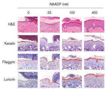 Tape stripping에 의한 피부 손상 동물 모델에 세포외 NAADP 처리 후 각질형성세포의 분화 표지 마커 염색