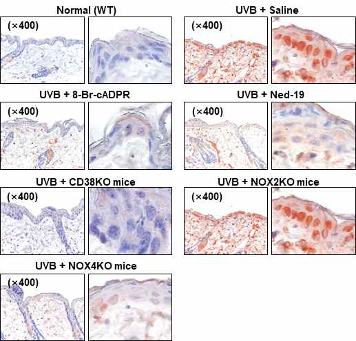 UVB-조사 후, WT, CD38 KO, NOX4 KO, 및 NOX2 KO 마우스에서 IL-1β에 대한 면 역화학 염색