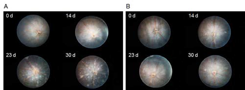 실험적 자가면역 포도막염 (EAU) 유도된 mouse 모델에서 sCD38의 치료 효과. A, EAU 유도 mouse eye. B, EAU 유도 후 sCD38 처리한 mouse eye