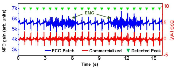 패치형 심전도 측정 시스템을 사용하여 측정된 ECG 파형(파랑 선)과 검출된 R 피크(초록 역삼각형)과 상용화된 시스템을 이용하여 측정된 ECG 파형(빨강 선)