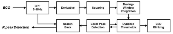 ECG 신호로부터 R 피크 검출 알고리즘 개략도