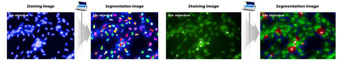 세포 핵 염색 후 segmentation 분석 (좌), Caspase 3/7 염색을 통한 세포사멸 약물 반응 (우)