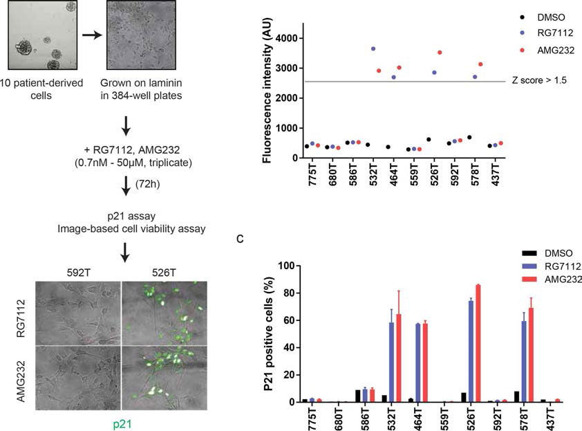 HCS를 이용한 교모세포종 환자유래세포의 MDM2 저해제 감수성 반응 결과