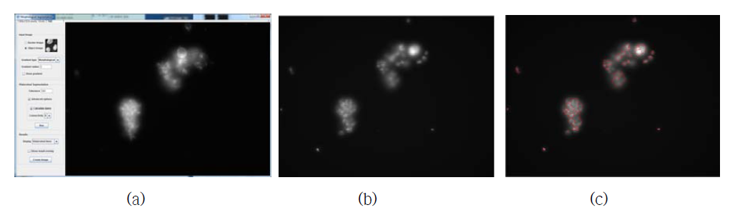 Fiji의 세포 핵 영상 분할 과정 (a) Watershed를 이용한 모폴로지 인터페이스, (b) 입력 뇌종양 세포 영상, (c) 영상 분할 결과
