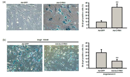 CYR61 induces cellular senescence in hCSMCs