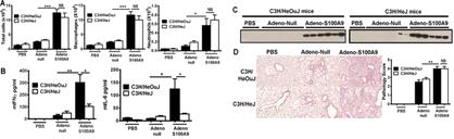 DAMPs 관련인자에 의한 IL-6 cytokine 조절 [PLoS One. 2015]