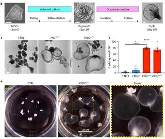 물리적 환경 변화를 통한 PKFD 유전모델 조직 제작 [Cruz et al., 2017]