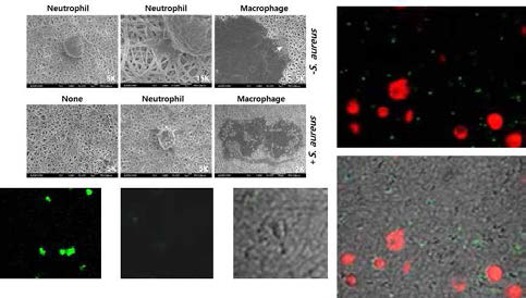 PVA membrane에 부착한 호중구 및 대식구, 호중구와 포도상구균의 공배양 시 탐식작용을 관찰한 결과