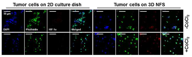 CT26 세포주로 구성된 종양조직으로부터 분리한 세포의 배양에서 HIF-1α 발현에 대한 CoCl2의 영향