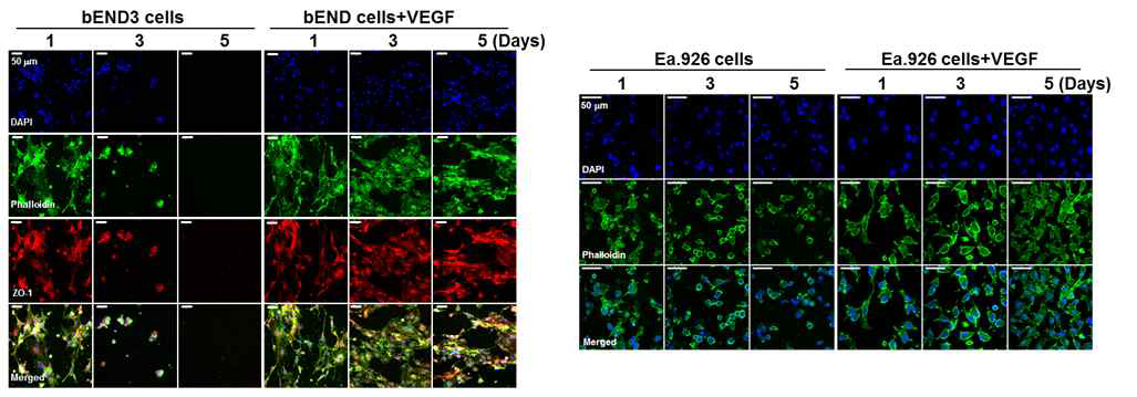 혈관내피세포의 3D 배양에서 세포형태 변화에 대한 VEGF의 영향