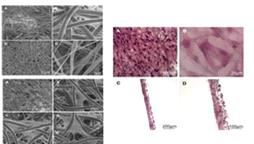 나노섬유 지지체에 배양된 인체 결막 섬유모세포. (좌) PCL 나노섬유 지지체에 6일 배양된 인체 결막 섬유모세포의 SEM 사진 (우), 헤마톡실린에오신(H&E) 염색 사진(x200, x400)