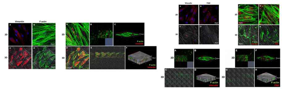 나노섬유 지지체에 배양한 인체 결막 섬유모세포의 세포골격 양상. (좌) 2차원 및 3차원 환경에서 6일 배양된 섬유모세포의 actin 및 vimentin 면역형광 사진(x400), (우) Actin과 vimentin의 co-localization 및 z-stack. 나노섬유 지지체에 배양한 인체 결막 섬유모세포의 focal adhesion 양상. (좌) 2차원 및 3차원 환경에서 6일 배양된 섬유모세포의 vinculin 및 focal adhesion kinase(FAK) 면역형광 사진(x400), (우) vinculin과 FAK의 co-localization 및 z-stack