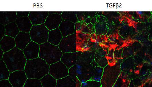 TGF-β2 유리체강내 주사 후 망막색소상피세포의 상피간엽이행 변화