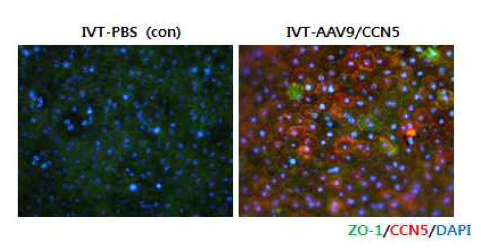 CCN5 유전자 발현에 의한 Ccl2 knockout 생쥐의 망막색소상피 치밀이음부 손상 억제