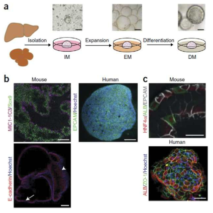 간 오가노이드의 분화