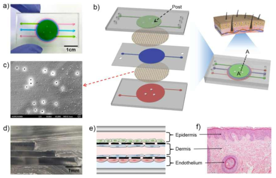 skin on a chip 개략도 (Skin-on-a-chip model simulating inflammation, edema and drug-based treatment - Maierdanjiang Wufuer, GeonHui Lee, Woojune Hur, Byoungjun Jeon, Byung Jun Kim, Tae Hyun Choi & SangHoon Lee)