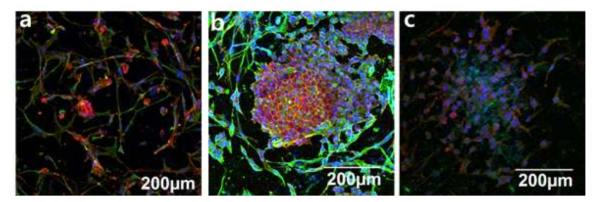 나노섬유에서의 섬유아세포와 프린트된 자궁경부암세포의 공동배양. a) 2×10⁴fibroblasts, b) 4×10⁴fibroblasts, c) 6×10⁴fibroblasts (F-actin: 빨강, β-tubulin: 초록, DAPI: 파랑)