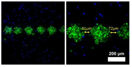 세포 패터닝 간격을 80μm 이내 설정하여 프린트한 사진 초록색(암세포), 파란색(섬유아세포)