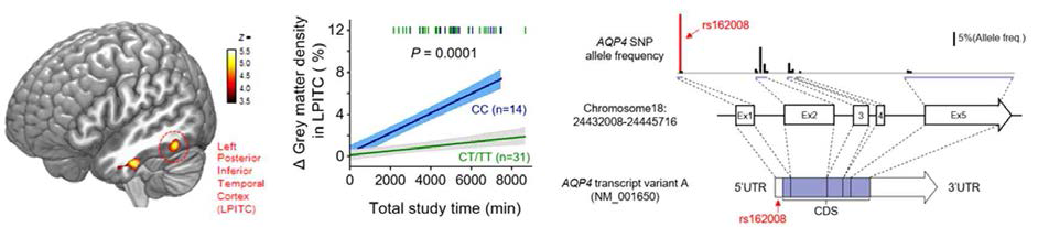 AQP4 유전자 변이에 따라서 변화되는 자극에 대한 뇌반응