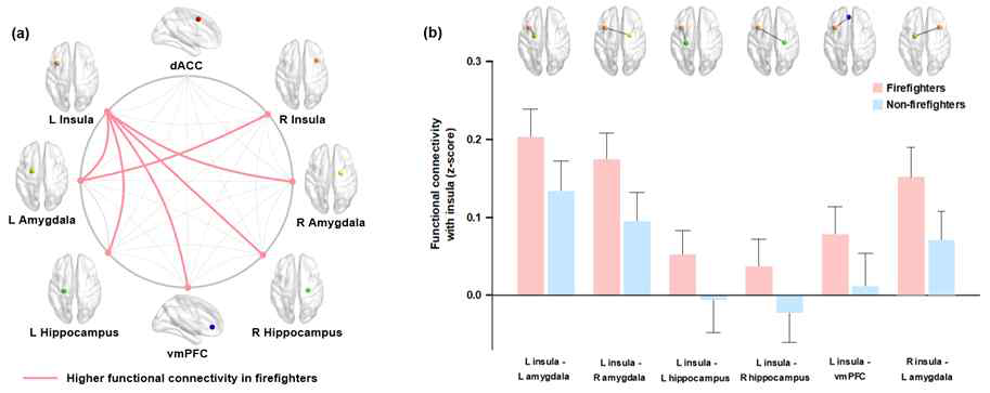 소방공무원에서 뇌 기능적 연결성의 이상