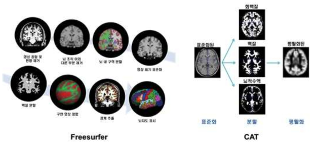 Freesurfer와 CAT을 이용한 분석의 개념도