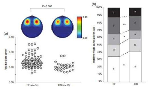 사별한 가족(BF)과 정상대조군(HC)의 뇌파 비교