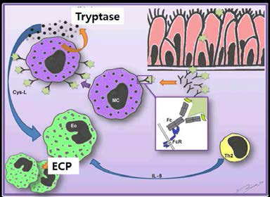 비강 점막내 항원에 의한 비만세포가 활성화되면 tryptase를 분비하며 이와함께 여러 염증성 매개 물질을 통해 호산구에서 ECP 의 분비를 유발함
