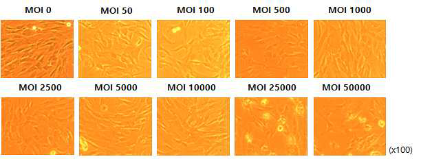 Adenovirus 벡터의 전달양에 따른 UC-MSC 변화 확인