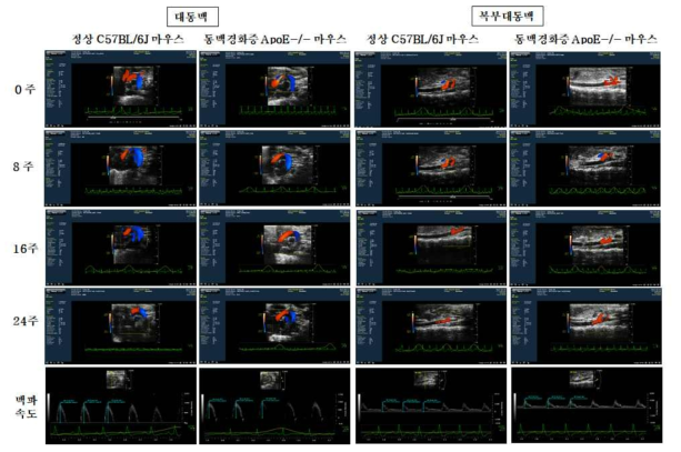 정상 및 동맥경화증 모델마우스의 대동맥 및 복부대동맥 기능분석을 위한 심장초음파 영상