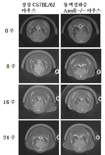 전임상 정상 및 동맥경화증 모델 마우스의 micro- CT 영상 데이터 정보의 확보