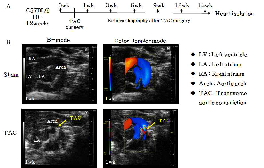 TAC 수술 계획(A)과 심장초음파(B)