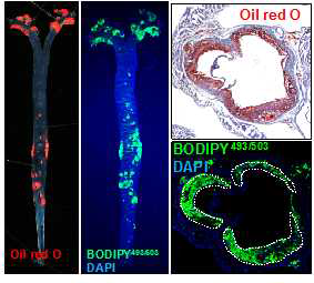 BODIPY 및 Oil red O 병변 염색 결과