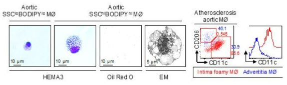 BODIPY 유세포분석법으로 추출한 포말 및 비포말 대식세포의 확인