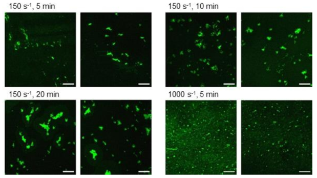 Shear stress와 처리시간에 따른 혈소판의 collagen에 대한 부착과 응집